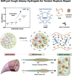 Stiff-yet-tough glassy hydrogels for tendon rupture repair